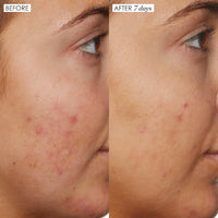 Sunday Riley - B3 Nice 10% Niacinamide serum